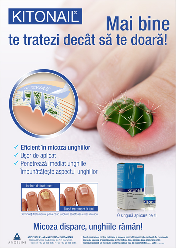 Kitonail — Print ad
