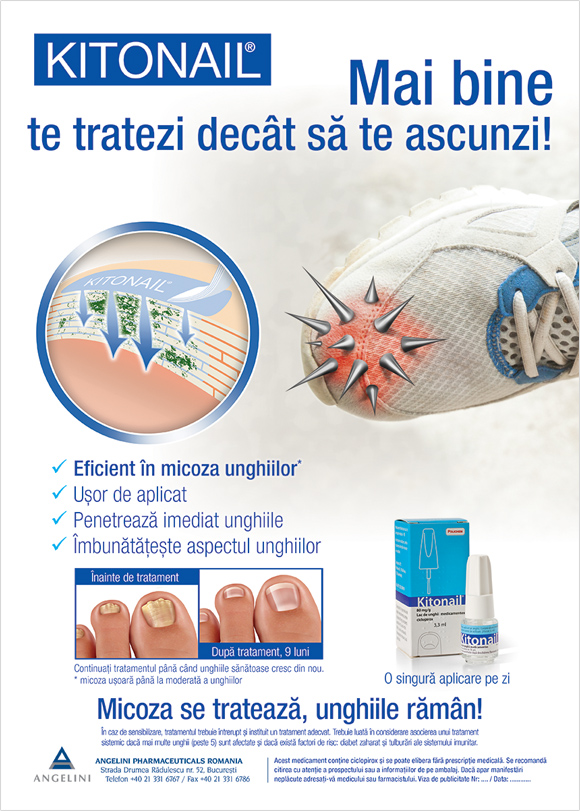 Kitonail — Print ad variant